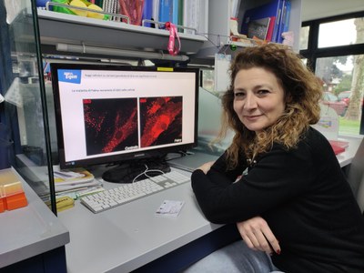 Fabry disease: TIGEM’s contribution to research