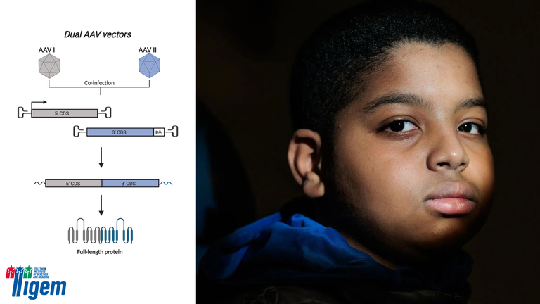 First gene therapy treatment for a hereditary form of deafness in the USA