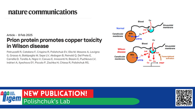 Unlocking Copper Toxicity: Prion Protein as a New Therapeutic Target in Wilson Disease