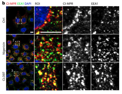 Distinct changes in endosomal composition promote NLRP3 inflammasome activation