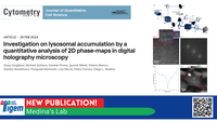Investigation on lysosomal accumulation by a quantitative analysis of 2D phase-maps in digital holography microscopy