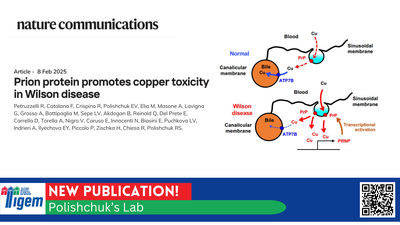 Prion protein promotes copper toxicity in Wilson disease