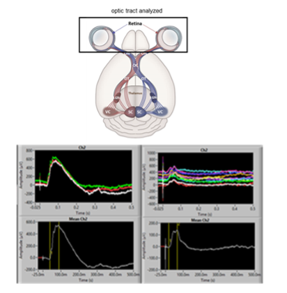 Electroretinogram.png