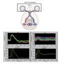Electroretinogram.png